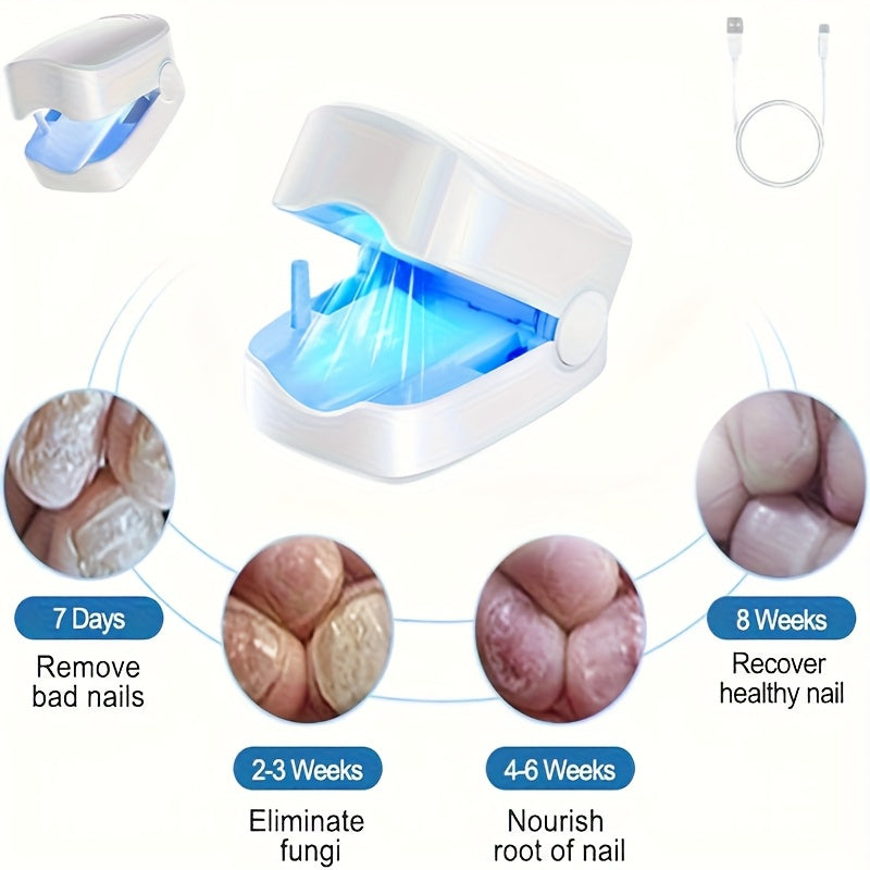 1/2pcs Rechargeable Dual Physical Light Nail Lamp - 420nm Visible Blue Laser & 910nm Infrared, 3-in-1 Treatment for Inflammation Reduction, Painless Penetration & High Energy Activation, FSA/HSA Compliant USB-Powered for Toen