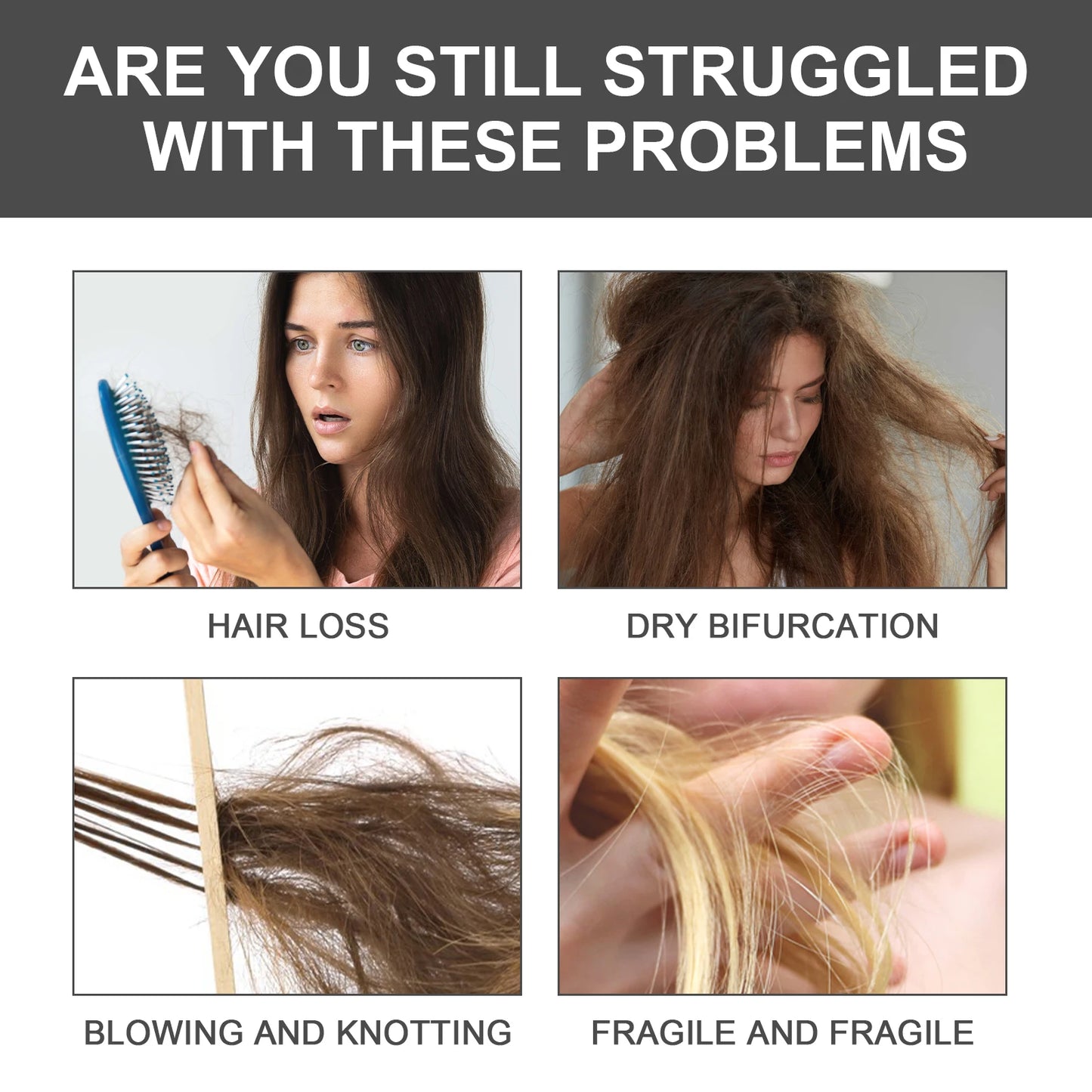 Ouhoe 1set Onion Biotin Rosemary Shampoo Set Nourish Roots Reduce Hair Loss Clean Dandruff Repair Frizz Thicken Hair Shampoo Set