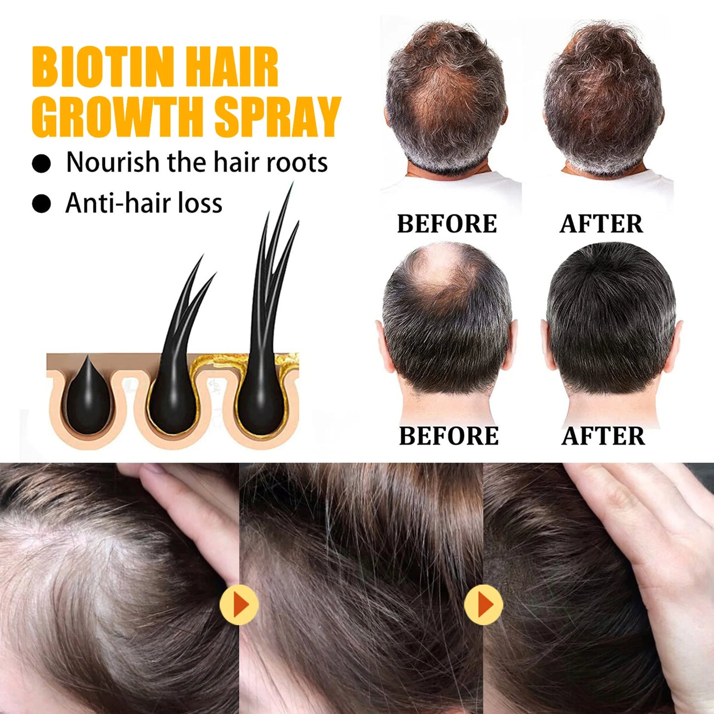 Biotin Hair Care Spray Hair Repair Serum Spray Nourish Scalp Hair Follicle Reduce Hair Loss Hair Strengthening Spray 30ml/pc