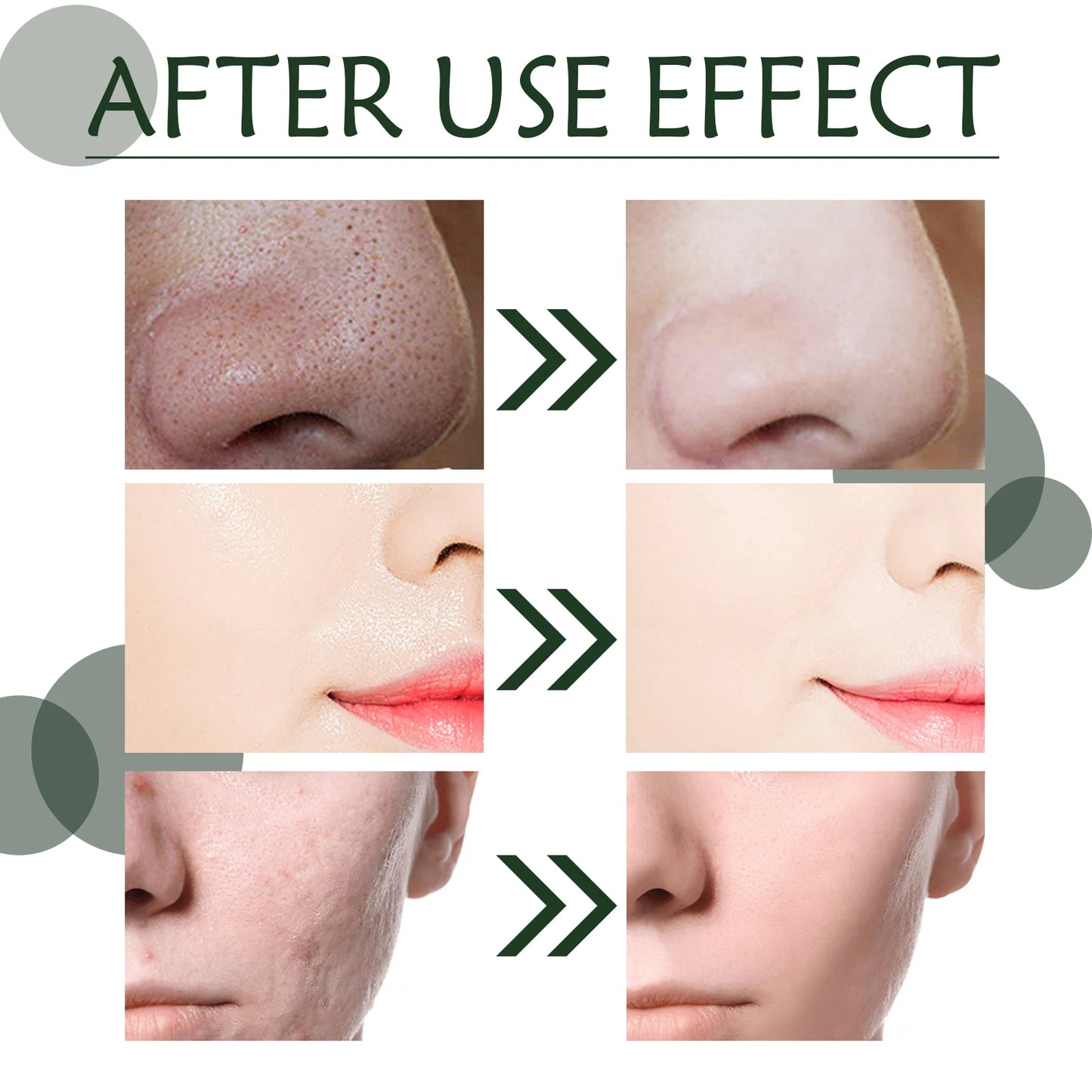 Green Tea Solid Cleansing Mask To Remove Blackheads and Acne, Apply Mud Mask, Natural Hydrating and Moisturizing Mask