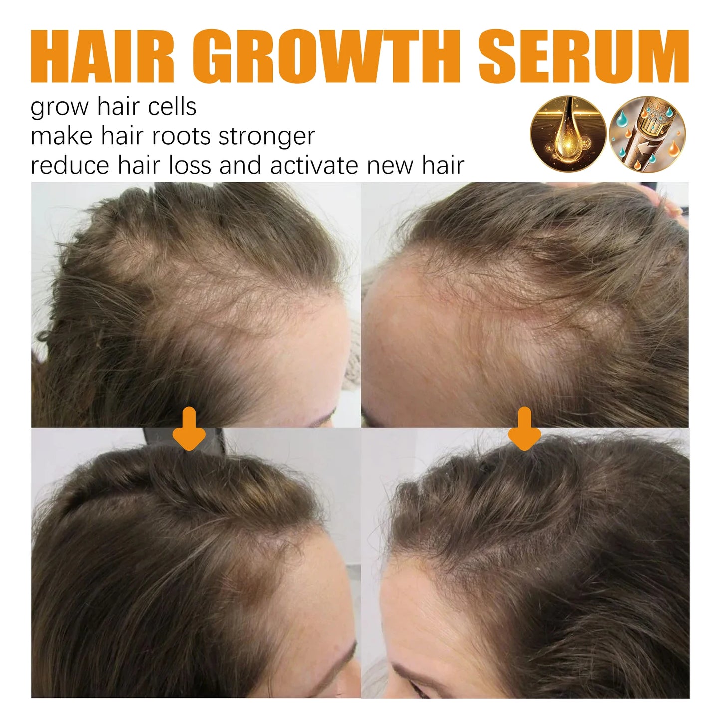 Biotin Hair Care Spray Hair Repair Serum Spray Nourish Scalp Hair Follicle Reduce Hair Loss Hair Strengthening Spray 30ml/pc