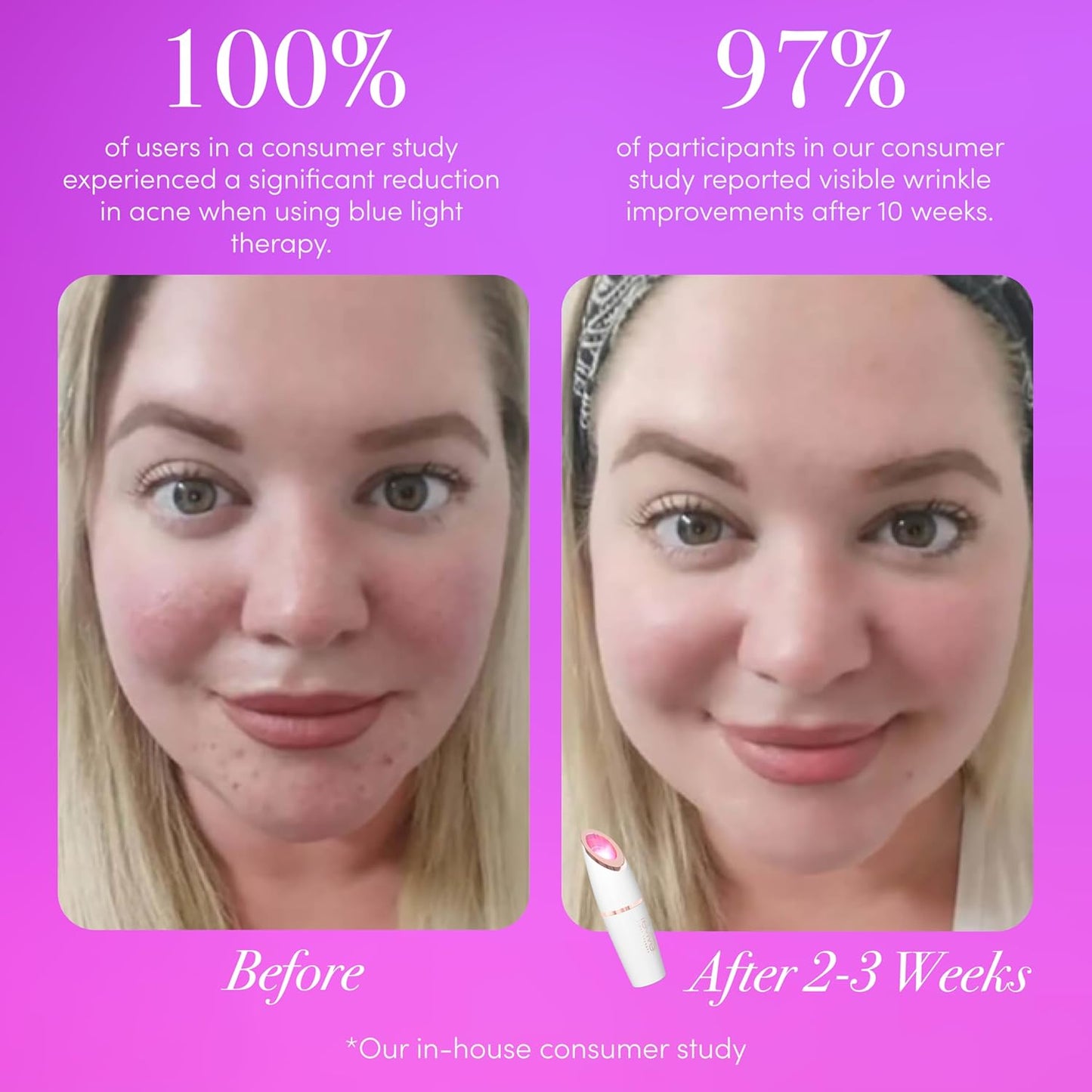 ReVive Light Lux Collection Spot Device for Face Care